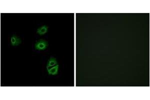 Immunofluorescence analysis of A549 cells, using OR2B2 Antibody. (OR2B2 抗体  (AA 241-290))