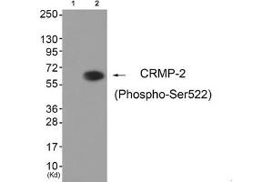 Western blot analysis of extracts from HuvEc cells (Lane 2), using CRMP-2 (Phospho-Ser522) Antibody. (DPYSL2 抗体  (pSer522))