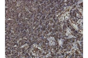 Immunoperoxidase of monoclonal antibody to HCLS1 on formalin-fixed paraffin-embedded human lymph node. (HCLS1 抗体  (AA 266-355))