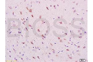 Formalin-fixed and paraffin embedded rat brain labeled with Anti-phospho-NRP1(Thr916) Polyclonal Antibody, Unconjugated (ABIN710756) at 1:200 followed by conjugation to the secondary antibody and DAB staining. (Neuropilin 1 抗体  (pThr916))
