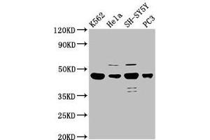 Western Blot Positive WB detected in: K562 whole cell lysate, Hela whole cell lysate, SH-SY5Y whole cell lysate, PC-3 whole cell lysate All lanes: LYAR antibody at 2. (LYAR 抗体  (AA 1-379))