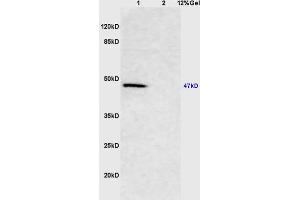 Lane 1: mouse brain lysates Lane 2: mouse kidney lysates probed with Anti Smad3 Polyclonal Antibody, Unconjugated (ABIN747023) at 1:200 in 4 °C. (Smad2/3 抗体  (AA 30-80))