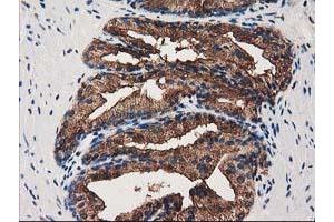 Image no. 2 for anti-Annexin A3 (ANXA3) antibody (ABIN1496642) (Annexin A3 抗体)
