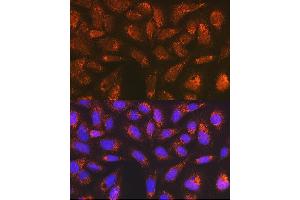 Immunofluorescence analysis of U-2 OS cells using Versican Rabbit mAb (ABIN7271309) at dilution of 1:100 (40x lens). (Versican 抗体)