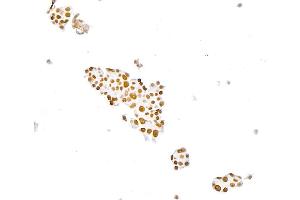 Immunocytochemistry (ICC) image for anti-Paired Box 8 (PAX8) (AA 225-275) antibody (ABIN7795777)
