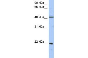 WB Suggested Anti-GUK1 Antibody Titration: 0. (GUK1 抗体  (Middle Region))