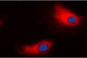 Immunofluorescent analysis of ATP1A1 staining in HeLa cells. (ATP1A1 抗体  (N-Term))