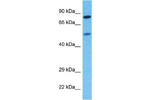 Western Blotting (WB) image for anti-Potassium Voltage-Gated Channel, Shaw-Related Subfamily, Member 4 (KCNC4) (N-Term) antibody (ABIN5515526)