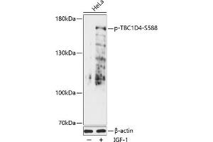 Western blot analysis of extracts of HeLa cells, using Phospho-TBC1D4-S588 antibody (ABIN7270747) at 1:2000 dilution. (TBC1D4 抗体  (pSer588))