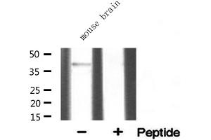 Western blot analysis of extracts from mouse brian, using SGCA antibody. (SGCA 抗体  (Internal Region))