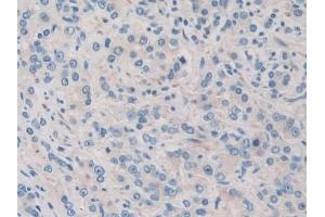 Immunohistochemistry (IHC) image for anti-Pyruvate Dehydrogenase Complex, Component X (PDHX) (AA 220-468) antibody (ABIN7443305)