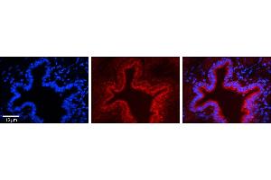 Immunohistochemistry (IHC) image for anti-Signal Recognition Particle Receptor, B Subunit (SRPRB) (Middle Region) antibody (ABIN2783830)