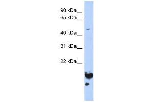 WB Suggested Anti-NUSAP1 Antibody Titration:  0. (NUSAP1 抗体  (Middle Region))