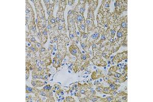Immunohistochemistry of paraffin-embedded human liver injury using EPO antibody. (EPO 抗体)