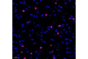 Immunofluorescence of paraffin embedded mouse brain using Adenosine kinase (ABIN7072953) at dilution of 1: 300 (400x lens) (ADK 抗体)