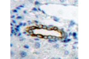 Used in DAB staining on fromalin fixed paraffin-embedded Liver tissue (IL20RB 抗体  (AA 37-290))