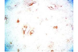 Rat brain tissue was stained by Rabbit Anti-CB2 Receptor (323-360) Serum (CNR2 抗体  (AA 323-360))