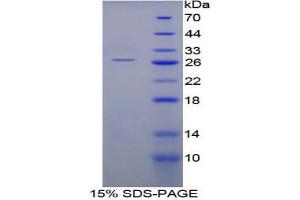 SDS-PAGE analysis of Mouse SHC2 Protein. (SHC2 蛋白)