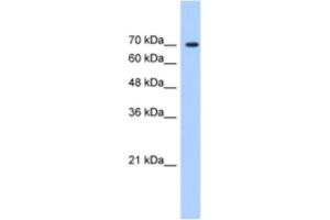 Western Blotting (WB) image for anti-LAS1-Like (LAS1L) antibody (ABIN2461009)