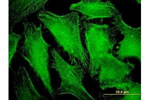 Immunofluorescence of monoclonal antibody to CDC42BPB on HeLa cell. (CDC42BPB 抗体  (AA 1580-1679))