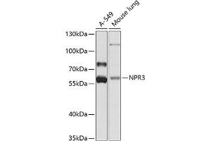 Western blot analysis of extracts of various cell lines, using NPR3 antibody (ABIN6133449, ABIN6144785, ABIN6144786 and ABIN6224163) at 1:1000 dilution. (NPR3 抗体  (AA 272-541))