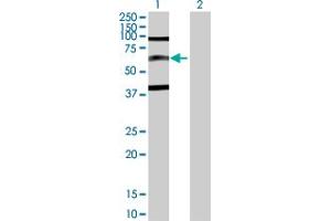 Western Blot analysis of SP110 expression in transfected 293T cell line by SP110 MaxPab polyclonal antibody. (SP110 抗体  (AA 1-547))