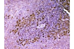 IHC testing of FFPE rat spleen tissue with Ada antibody at 1ug/ml. (ADA 抗体  (AA 2-241))