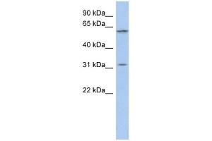 C1ORF110 antibody used at 1 ug/ml to detect target protein. (C1ORF110 抗体  (Middle Region))