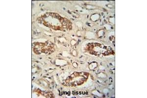 PPM1L antibody immunohistochemistry analysis in formalin fixed and paraffin embedded human lung tissue followed by peroxidase conjugation of the secondary antibody and DAB staining. (PPM1L 抗体  (C-Term))