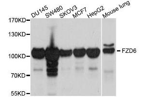 Western blot analysis of extracts of various cell lines, using FZD6 antibody. (FZD6 抗体  (AA 19-201))