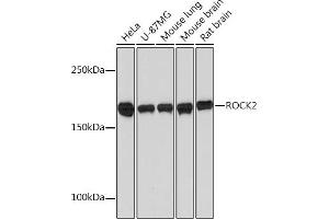 Western blot analysis of extracts of various cell lines, using ROCK2 Rabbit mAb (ABIN7269972) at 1:1000 dilution. (ROCK2 抗体)