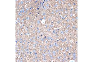 Immunohistochemistry (IHC) image for anti-Syntaxin 1A (Brain) (STX1A) antibody (ABIN7270684)