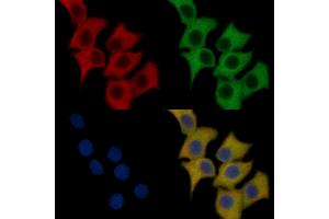 Flt3/CD135 Mouse Monoclonal Antibody staining HepG2 cells by IF/ICC. (FLT3 抗体  (C-Term))