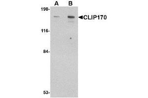 Image no. 1 for anti-CAP-GLY Domain Containing Linker Protein 1 (CLIP1) (C-Term) antibody (ABIN1492177) (CLIP1 抗体  (C-Term))