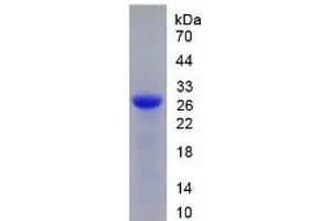 SDS-PAGE of Protein Standard from the Kit (Highly purified E.