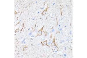 Immunohistochemistry of paraffin-embedded rat brain using Neurofilament H Rabbit mAb (ABIN7268866) at dilution of 1:100 (40x lens). (NEFH 抗体)