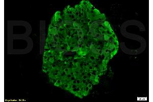 Formalin-fixed and paraffin embedded rat pancreas tissue labeled with Anti-Insulin Polyclonal Antibody, Unconjugated (ABIN724265) 1:200 followed by conjugation to the secondary antibody Goat Anti-Rabbit IgG, FITC conjugated used at 1:200 dilution for 40 minutes at 37°C. (Insulin 抗体  (AA 46-59))