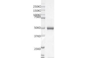 Western Blotting (WB) image for SMYD Family Member 5 (SMYD5) protein (DYKDDDDK Tag) (ABIN2669670)