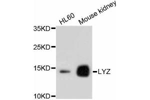 Western blot analysis of extracts of various cell lines, using LYZ antibody (ABIN4904274). (LYZ 抗体)