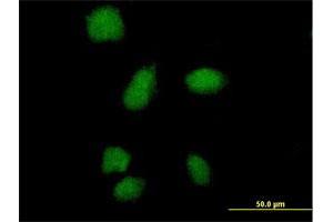 Immunofluorescence of purified MaxPab antibody to SMA4 on HeLa cell. (SMN1 抗体  (AA 1-140))