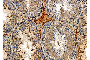 ABIN6259907 and ABIN6276919 at 1/100 staining Mouse testis tissue by IHC-P. (AMBP 抗体  (C-Term))