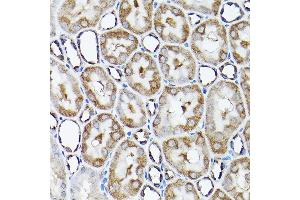 Immunohistochemistry of paraffin-embedded rat kidney using SNAPIN Rabbit pAb  at dilution of 1:200 (40x lens).