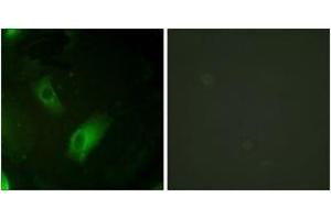 Immunofluorescence analysis of HeLa cells, using IREB1 (Ab-138) Antibody. (Aconitase 1 抗体  (AA 106-155))