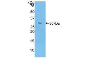 Western blot analysis of recombinant Mouse CA125. (MUC16 抗体  (AA 2-258))
