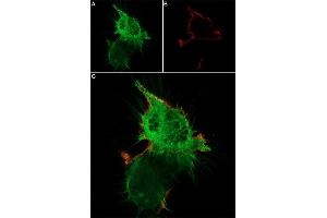 Live cell imaging of ω-Agatoxin IVA-ATTO Fluor-647N in differentiated  cells. (omega-agatoxin IVA peptide (Atto 647N))