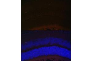 Immunofluorescence analysis of mouse retina using RDH5 Polyclonal Antibody (ABIN6130851, ABIN6146839, ABIN6146840 and ABIN6224076) at dilution of 1:100 (40x lens). (RDH5 抗体  (AA 24-318))
