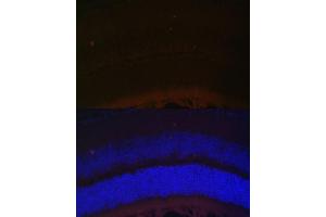 Immunofluorescence analysis of mouse retina using RDH5 Polyclonal Antibody (ABIN6130851, ABIN6146839, ABIN6146840 and ABIN6224076) at dilution of 1:100 (40x lens). (RDH5 抗体  (AA 24-318))