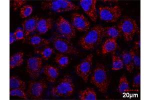 Proximity Ligation Assay (PLA) image for AKT1 & FOXO3 Protein Protein Interaction Antibody Pair (ABIN1340060)
