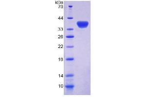SDS-PAGE analysis of Rat GBP4 Protein. (GBP4 蛋白)