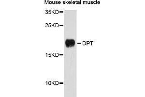 Western blot analysis of extracts of mouse skeletal muscle cells, using DPT antibody. (Dermatopontin 抗体)